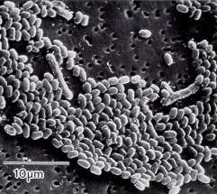 Натиснете снимката за да я уголемите

Име:anthrax_micro.jpg
Прегледи:1
Размер:13.8 КБ
ID:5969893