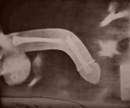 Натиснете снимката за да я уголемите

Име:tumblr_kwslcc7lUN1qz7hmlo1_500.jpg
Прегледи:1
Размер:84.4 КБ
ID:5698118