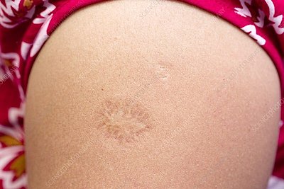 Натиснете снимката за да я уголемите

Име:EVwAdpfWoAI-KIe.jpg
Прегледи:357
Размер:75.4 КБ
ID:6796280