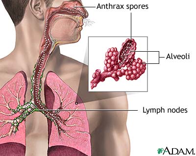 Натиснете снимката за да я уголемите

Име:inhalation-anthrax.jpg
Прегледи:1
Размер:22.8 КБ
ID:5969892